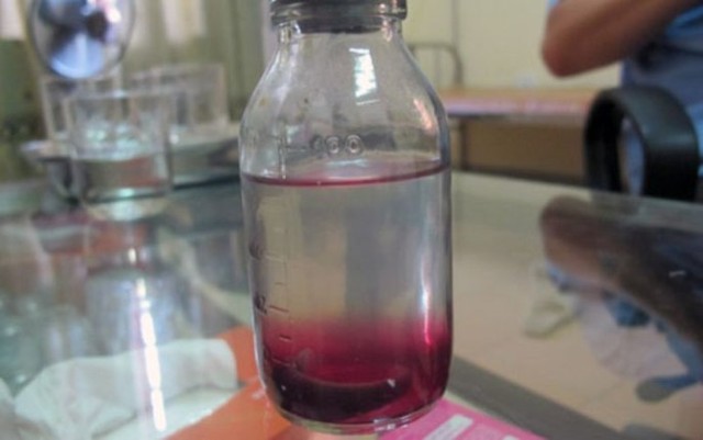 Hãi hùng đỉa dài 5cm 