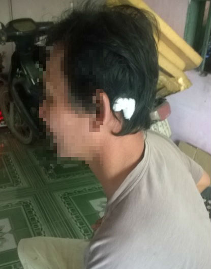 Bàng hoàng cả gia đình bị chém gục tại nhà