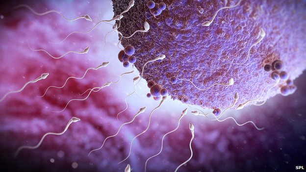 Thói quen để điện thoại trong túi quần có thể dẫn đến vô sinh? 