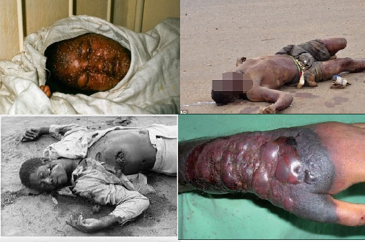 Dịch Ebola: Bé 12 tuổi bị nhốt cùng thi thể mẹ đến chết