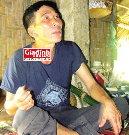 Phương pháp nối xương lạ kỳ 