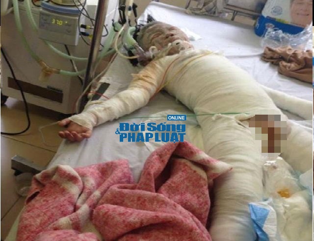 Một phút bất cẩn, cả gia đình nguy kịch