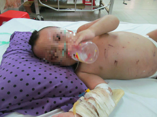 Bà ngoại đánh dã man cháu 2 tuổi vì làm vỡ chai dầu gió