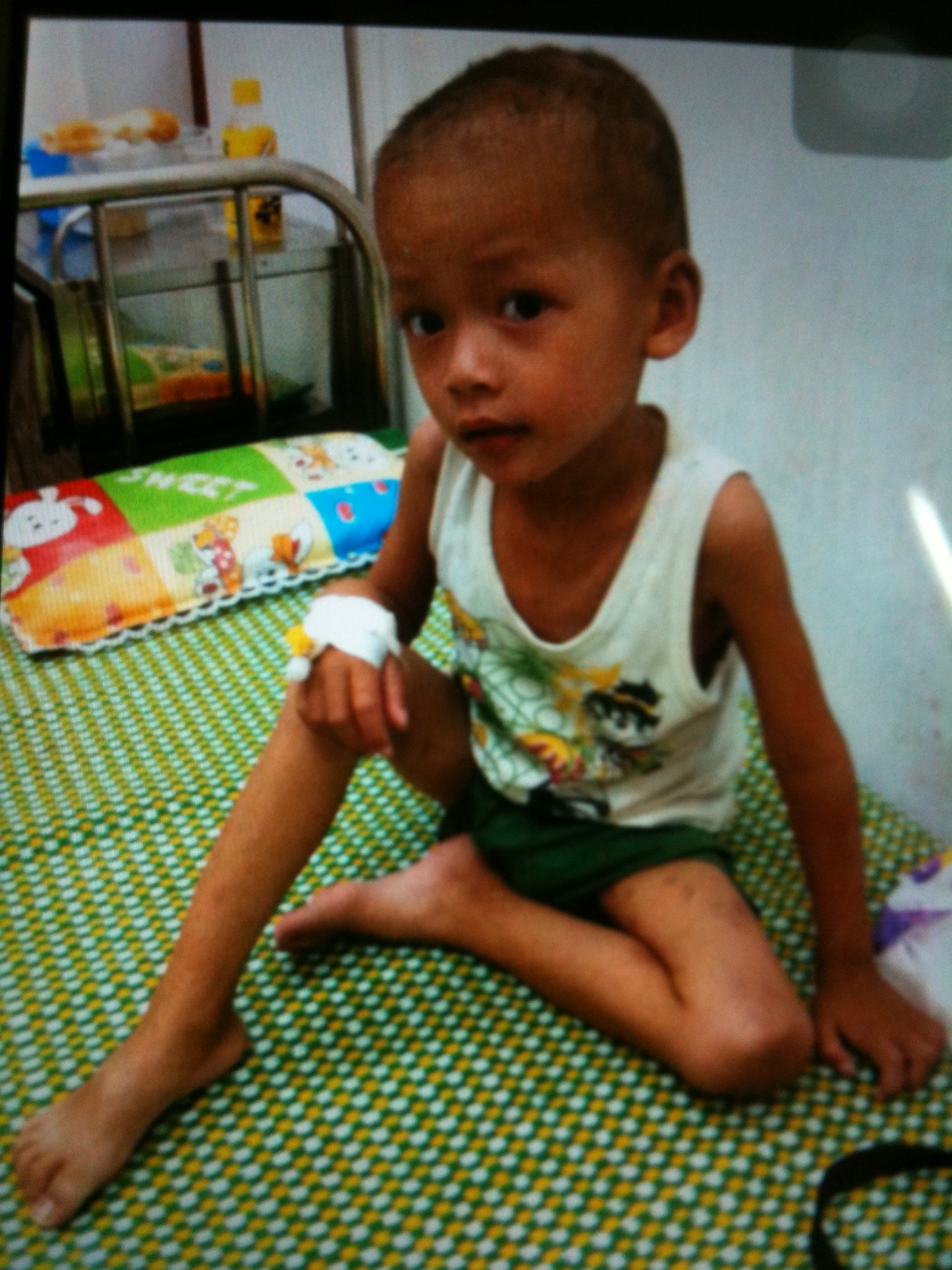 Đắng lòng nhìn cháu bé mồ côi chờ chết vì 