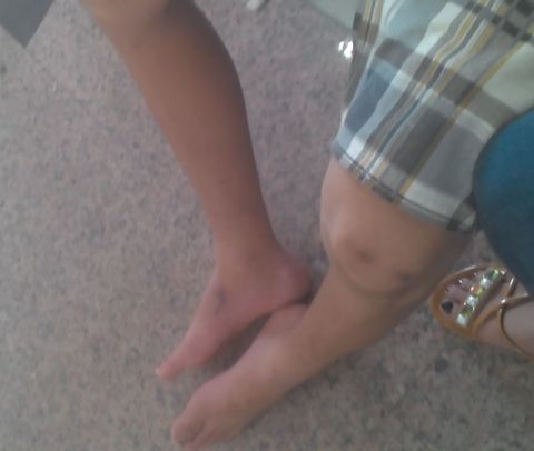 Mẹ tố công an đánh con trai bại liệt hai chân