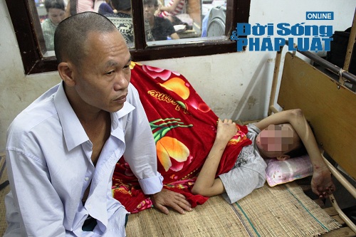 Kẻ hành hung bé khuyết tật từng muốn nhận nuôi nạn nhân