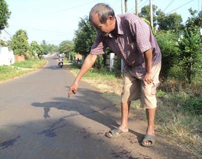 Bị côn đồ chặn đánh, nam thanh niên đứt lìa bàn tay