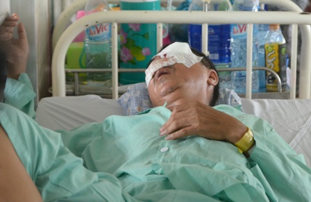 Hành khách bị ném đá trên QL 14 bị hỏng hoàn toàn mắt trái