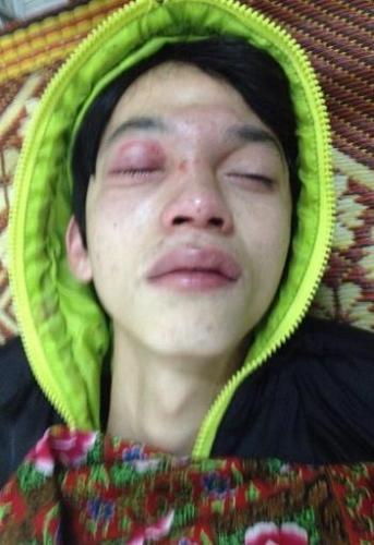 Thanh niên nhập viện vì “va chạm” CSGT: Tạm đình chỉ 2 chiến sĩ