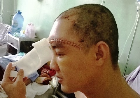 Liên tục xảy ra án mạng sặc mùi xã hội đen, dân Sài Gòn bất an