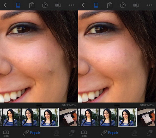 Thủ thuật Thủ thuật
