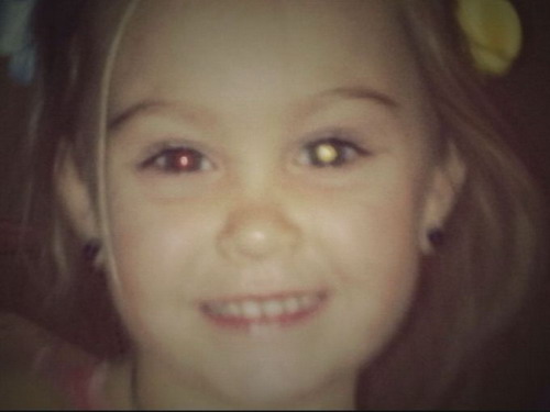 Đăng ảnh lên Facebook, mẹ cứu con thoát mù Đăng ảnh lên Facebook, mẹ cứu con thoát mù