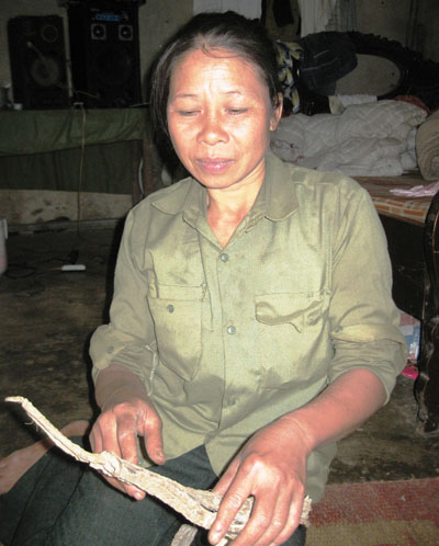 Bài thuốc giúp hàng ngàn người bị chó dại cắn “chết đi sống lại”