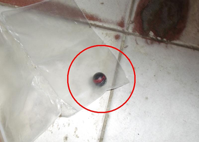 Nạn nhân bị công an xã bắn vào người và dùng dùi cui đánh