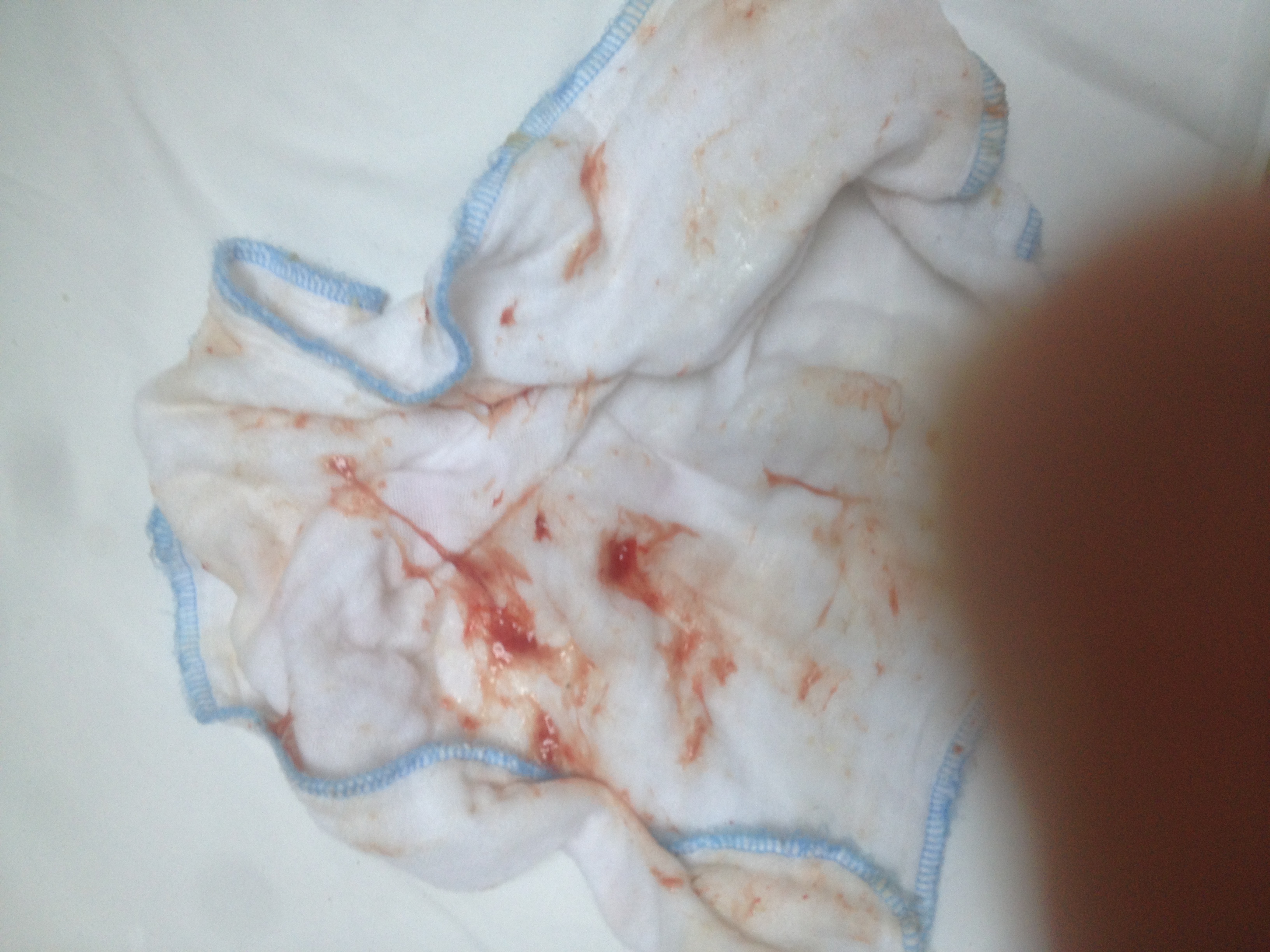 Phòng khám Nhi cao bị tố “rửa mũi cho bệnh nhi bằng cồn”