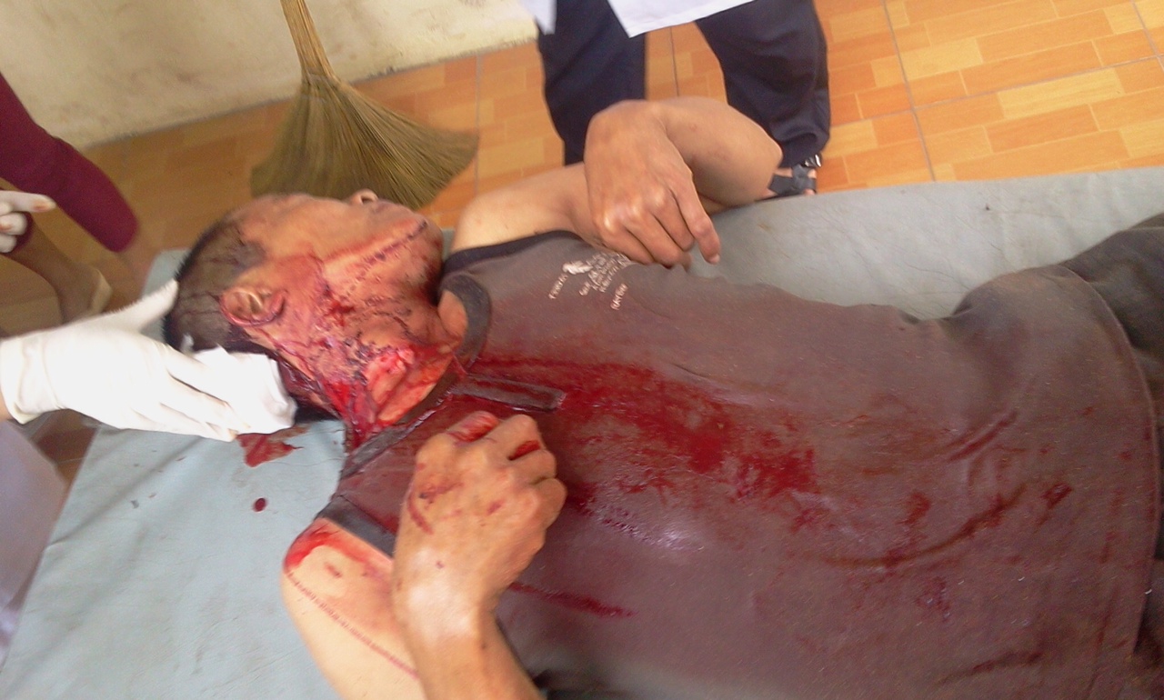   Nghi vấn thực phẩm chức năng Herbalife  chứa chất lạ