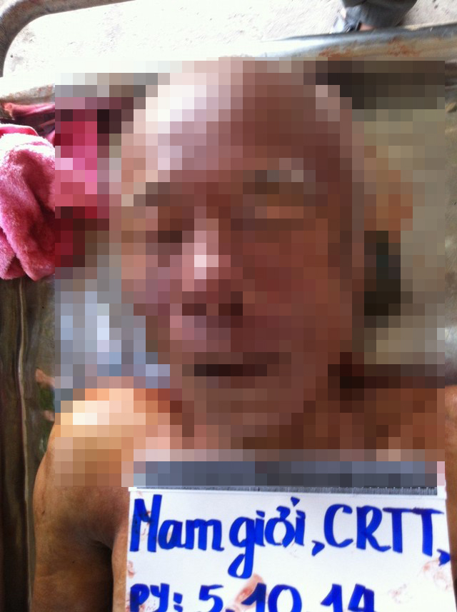 Đã có ảnh nhận dạng người đàn ông 70 tuổi chết ở TP HCM Đã có ảnh nhận dạng người đàn ông 70 tuổi chết ở TP HCM