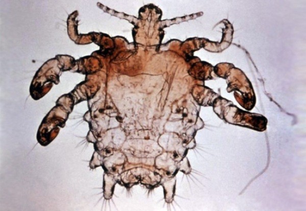 Bệnh Rận mu: Triệu chứng và tác hại Bệnh Rận mu: Triệu chứng và tác hại