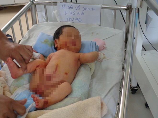 Hà Nội: Bé trai 6 ngày tuổi bị bỏ rơi ở quán cà phê Hà Nội: Bé trai 6 ngày tuổi bị bỏ rơi ở quán cà phê