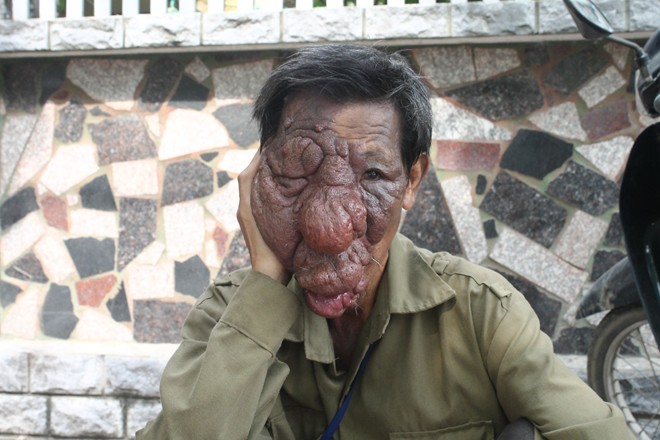 Ông già mang gương mặt “quỷ” mơ được... làm người