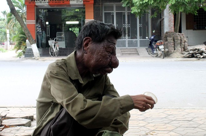 Ông già mang gương mặt “quỷ” mơ được... làm người