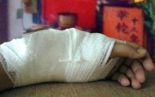 Giã nát... gà con đang sống để chữa gãy xương ở Long An Giã nát... gà con đang sống để chữa gãy xương ở Long An