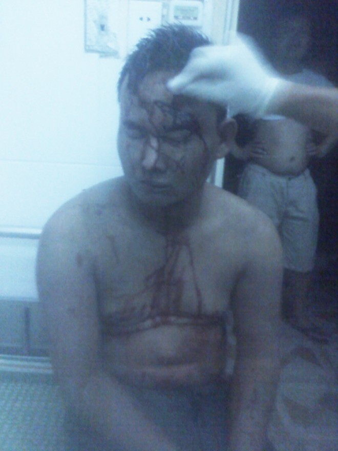 Nhân chứng kể vụ dân lột quần áo, đánh hội đồng tên trộm