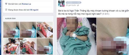 Vụ bé trai bị khoan vào vùng kín: Nhân viên bảo trì nói gì? Vụ bé trai bị khoan vào vùng kín: Nhân viên bảo trì nói gì?