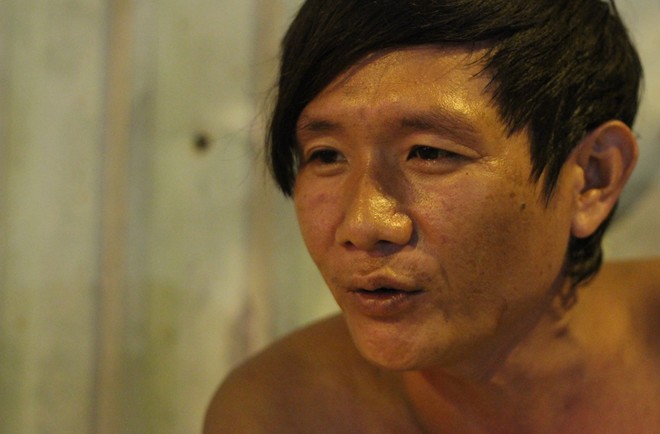 Cuộc sống của ba bố con trong túp lều trước tòa cao ốc