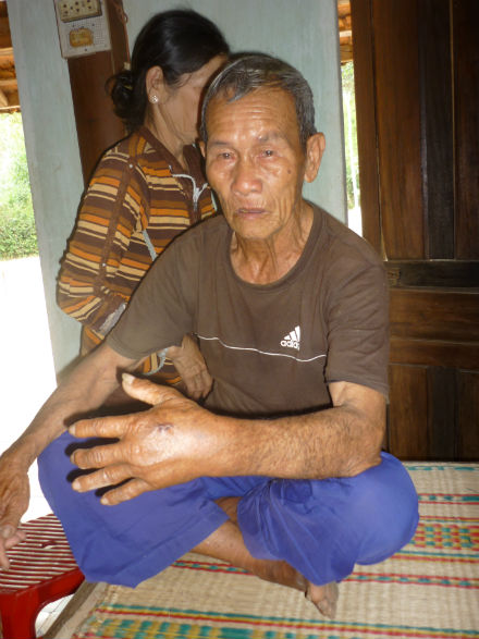 Con tôm hùm giống đổi mạng người