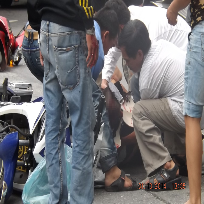 Tai nạn liên hoàn, một tu sĩ nguy kịch bởi vết thương lớn ở đầu Tai nạn liên hoàn, một tu sĩ nguy kịch bởi vết thương lớn ở đầu