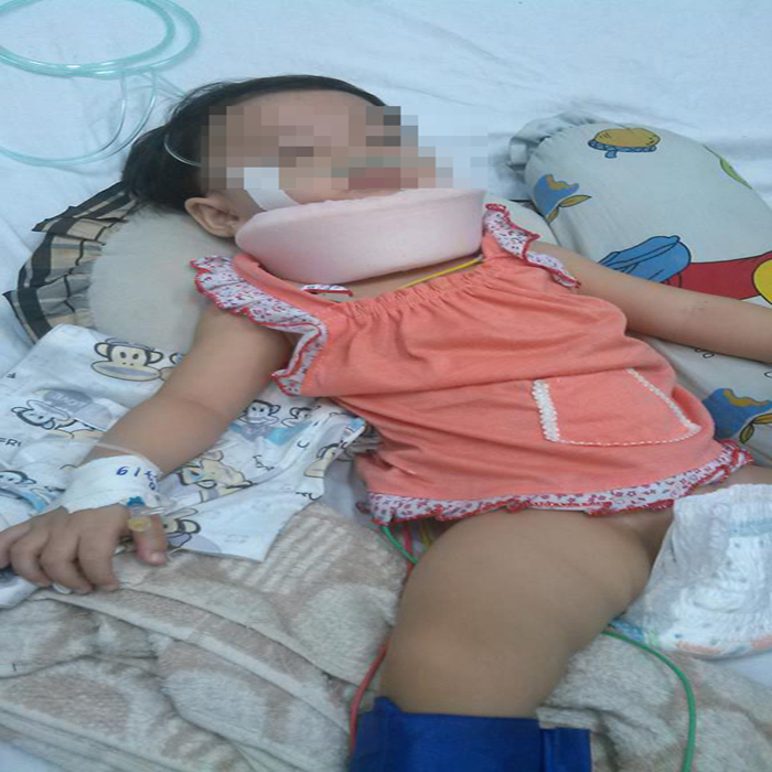 (bgiay)Bé gái 15 tháng tuổi bị mẹ và cha hờ bạo hành chấn thương 