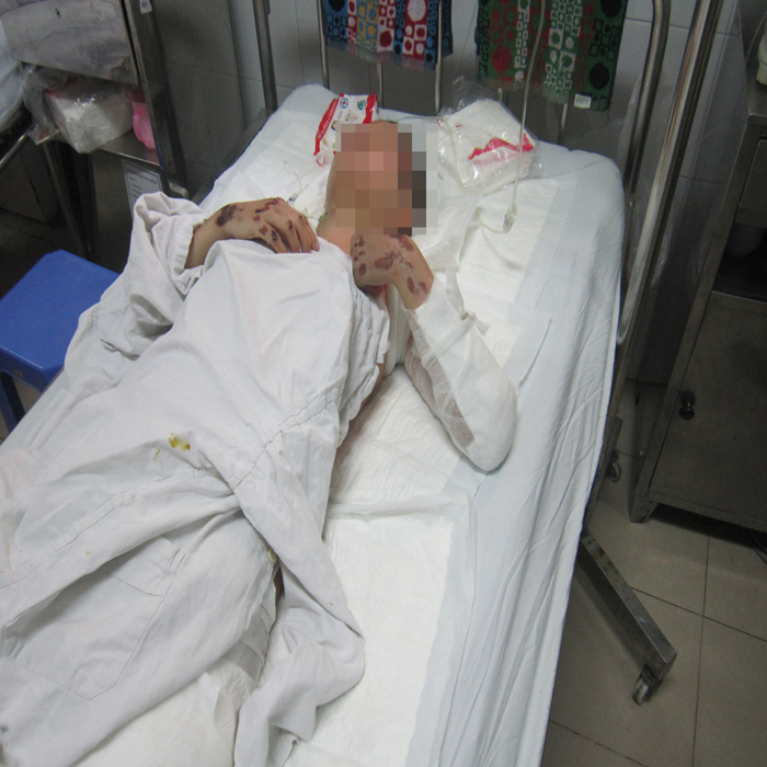 Thai phụ bị kéo 50m, sức khỏe đã có chiều hướng tốt