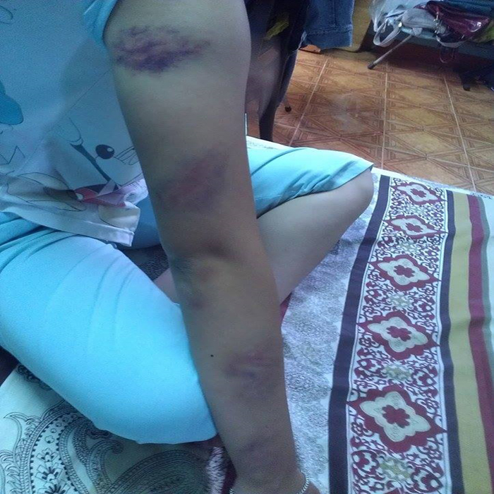 (bgiay)Lời kêu cứu của cô gái bị cha mẹ bạo hành ngăn cản vì... y