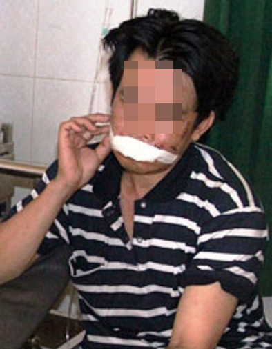 (bgiay)Bắt khẩn cấp kẻ mang 2 tiền án táo tợn đâm gục hai vợ chồn