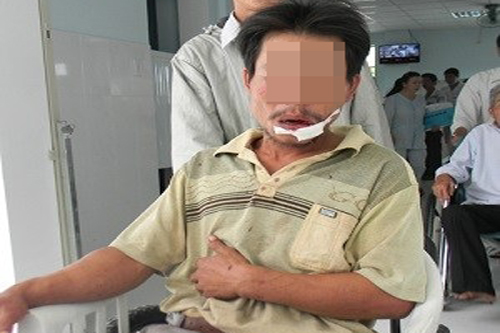 (bgiay)Cuộc đấu sinh tử và pha thoát chết trong gang tấc của chủ 