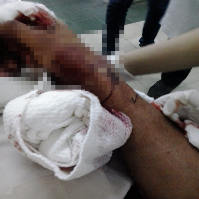 (BGIAY)Bình Dương: Truy bắt nhóm chém đứt hai tay bảo vệ trông xe (BGIAY)Bình Dương: Truy bắt nhóm chém đứt hai tay bảo vệ trông xe