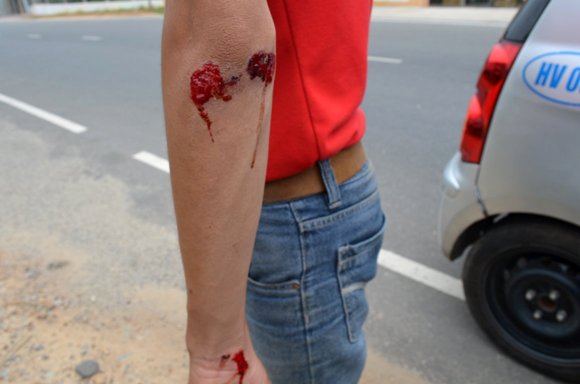 4 phóng viên bị côn đồ tấn công khi đang tác nghiệp 4 phóng viên bị côn đồ tấn công khi đang tác nghiệp