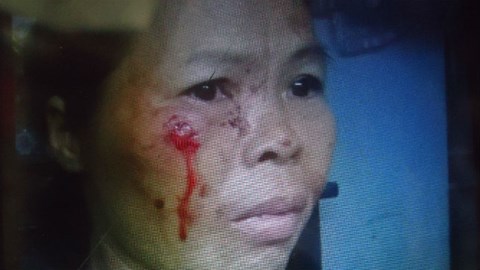 Nàng dâu hung dữ cắn tai, móc mắt người nhà như “ma cà rồng