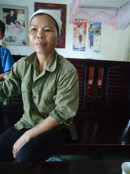 Nàng dâu hung dữ cắn tai, móc mắt người nhà như “ma cà rồng