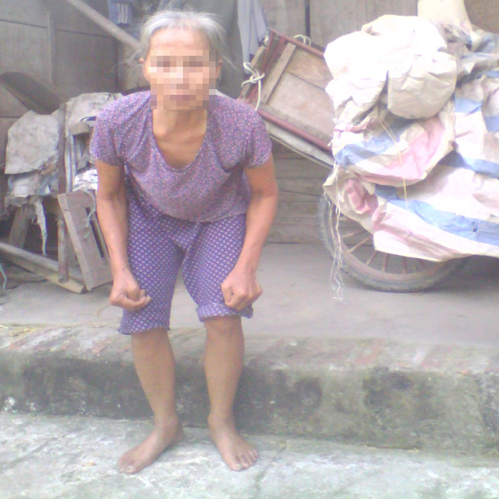 Xôn xao câu chuyên cả xã bỗng dưng….phát điên