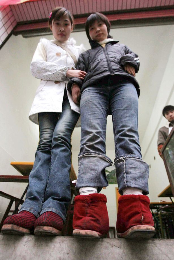 Cô gái có bàn chân kỳ lạ quay ngược ra phía sau