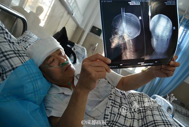 Người đàn ông bị con dao 