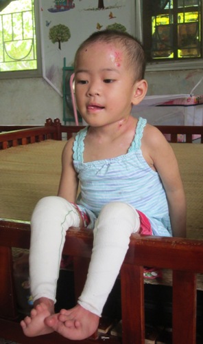 Cuộc sống em bé “có giòi” chùa Bồ Đề bước sang trang mới