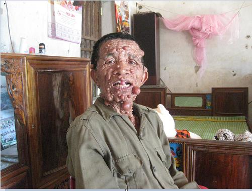 Xót thương người đàn ông mang thân hình ‘quỷ dữ’