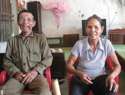 Xót thương người đàn ông mang thân hình ‘quỷ dữ’