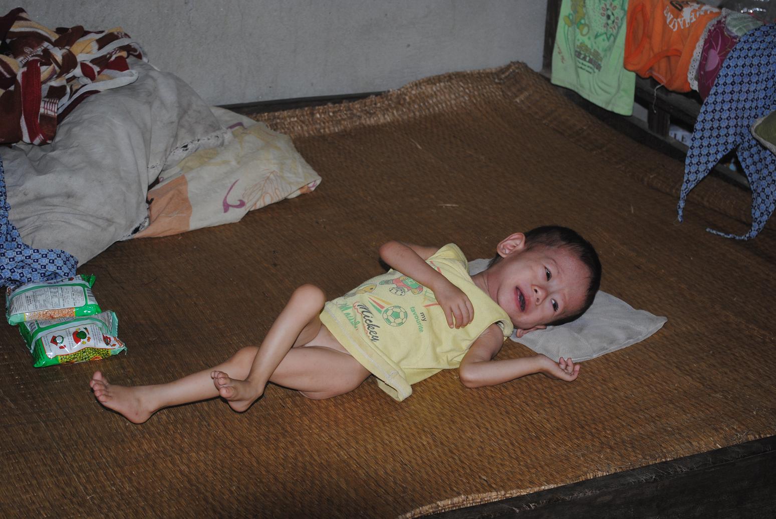 Xót thương nhìn cháu bé 1 tuổi bị bệnh tim bẩm sinh chờ cứu giúp 