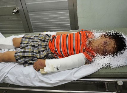 Bé trai 6 tuổi bị cha dượng đánh đập dã man