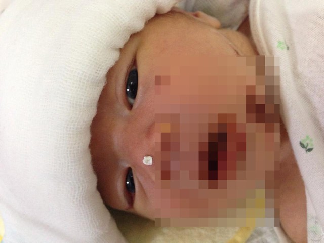 Bé trai còn nguyên cuống rốn bị mẹ bỏ rơi ở bệnh viện: Đau lòng c