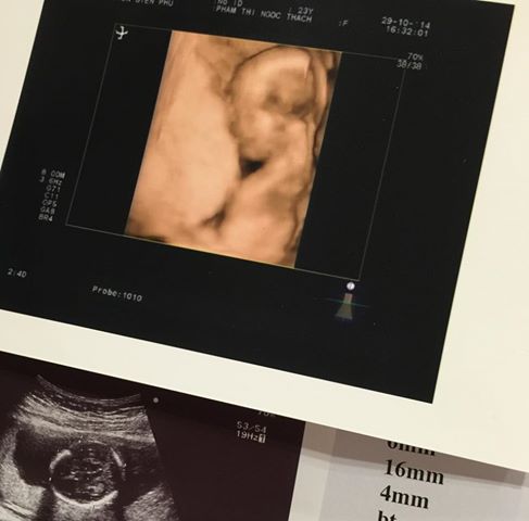 Ngọc Thạch khoe ảnh mang bầu 5 tháng Ngọc Thạch khoe ảnh mang bầu 5 tháng